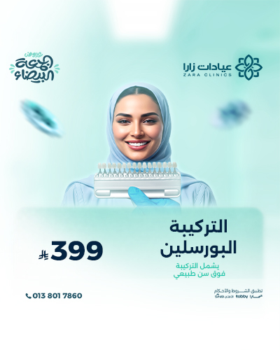 التركيبة البورسلين