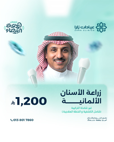 زراعة الأسنان الألمانية