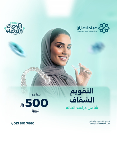 التقويم الشفاف