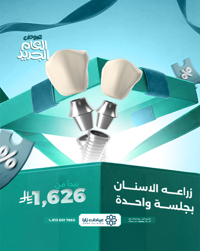 زراعه الاسنان  بجلسة واحدة  يبدأ