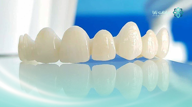تركيبات-الأسنان-الزيركون
