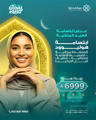 ابتسامة هوليوود