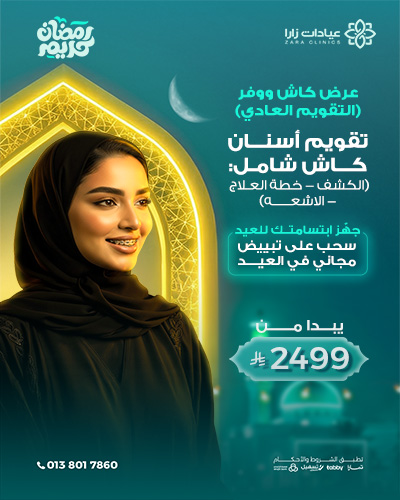 تقويم أسنان كاش