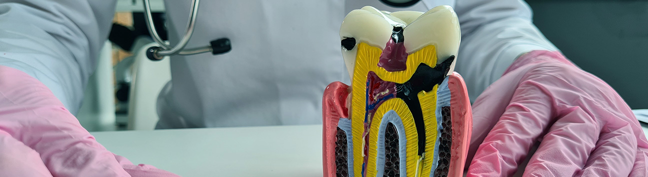 Root Canal Treatment