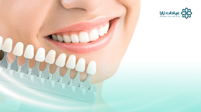 تجربتي-مع-تركيبات-الايماكس