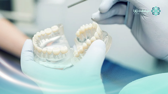 تركيبات-الأسنان-الزيركون