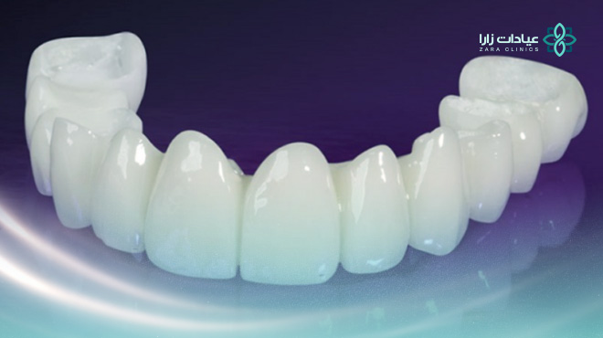 أسعار-تركيبات-الزيركون