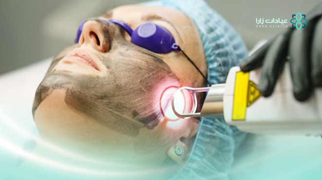 نتائج-الليزر-الكربوني