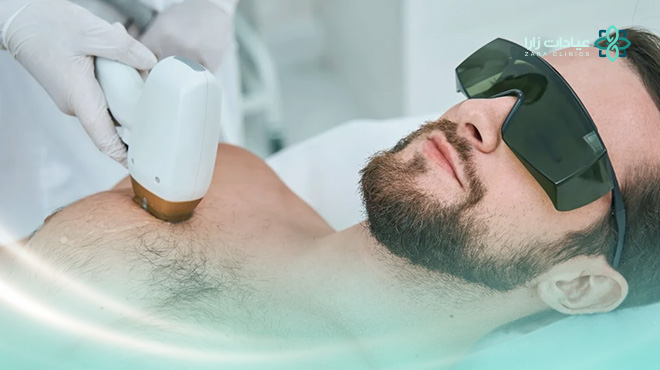 عروض-ازالة-الشعر-بالليزر-للرجال