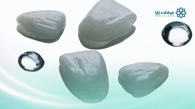 اسعار-تركيبات-الايماكس