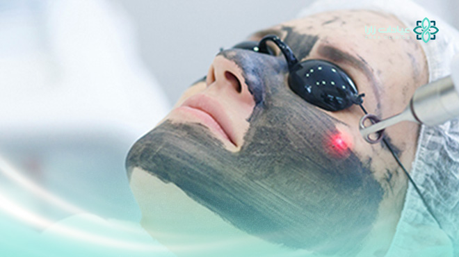 نصائح-بعد-الليزر-الكربوني