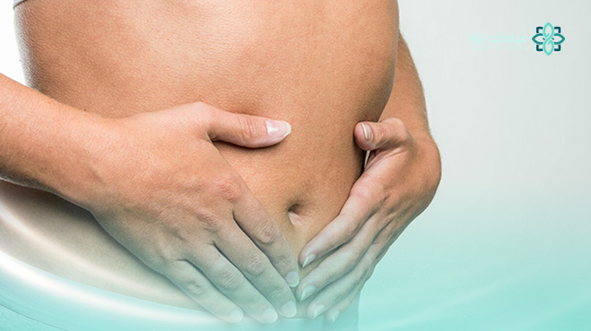 نحت-الجسم-بالليزر-قبل-وبعد