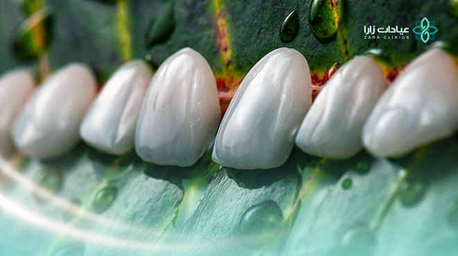 تركيبات-الايماكس-للاسنان