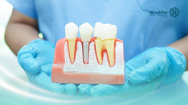 هل-زراعة-الأسنان-مؤلمة