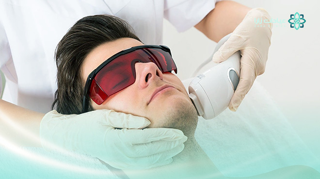 ازالة-الشعر-بالليزر-للرجال