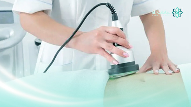 تكلفة-نحت-الجسم-بالليزر