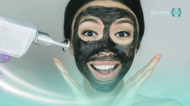 فوائد-الليزر-الكربوني-للوجه