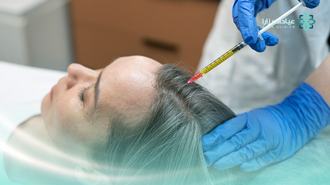 تجربتي-مع-الخلايا-الجذعية-للشعر