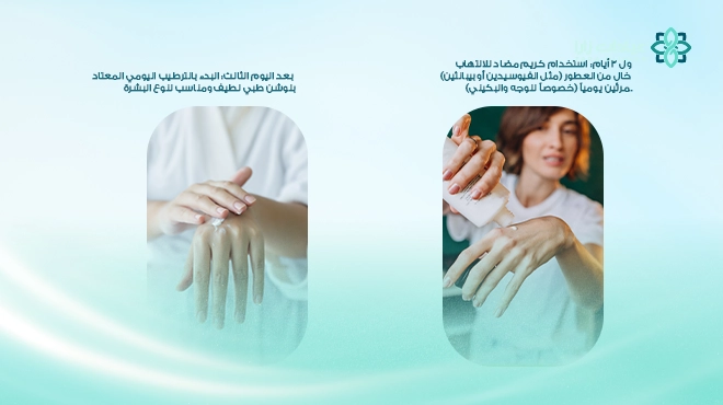 صورة-توضح-طريقة-العناية-بالبشرة-بعد-الليزر صورة-توضح-طريقة-العناية-بالبشرة-بعد-الليزر