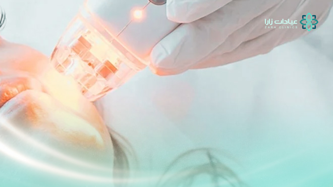 جهاز-سكارليت-لشد-البشره