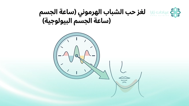 صورة-توضح-حب-الشباب-الهرموني
