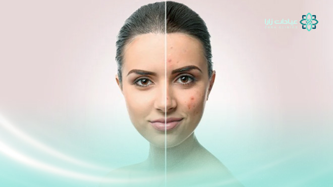 جهاز-بيكو-واي-الخبر