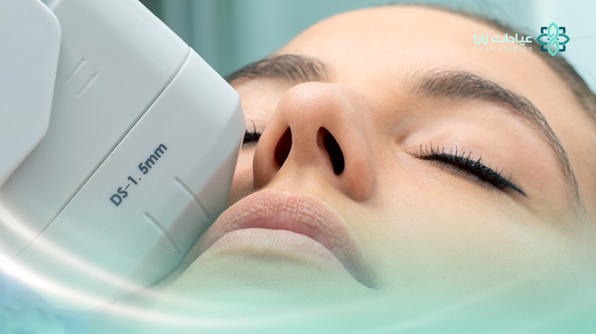 سعر-جلسة-الهايفو