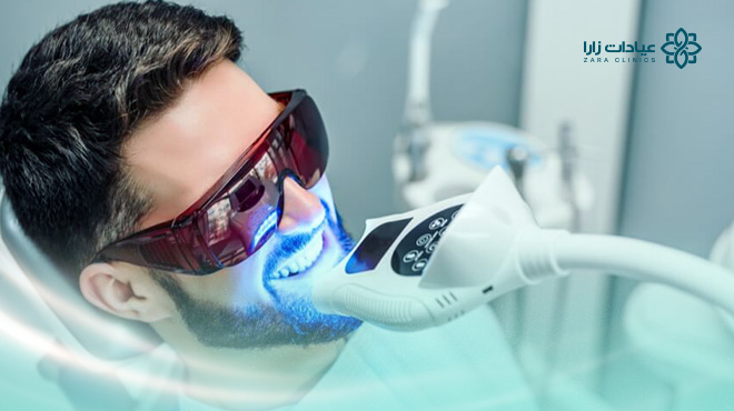 فوائد-تبييض-الاسنان-بالليزر