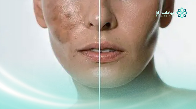 جهاز-بيكو-واي-الخبر