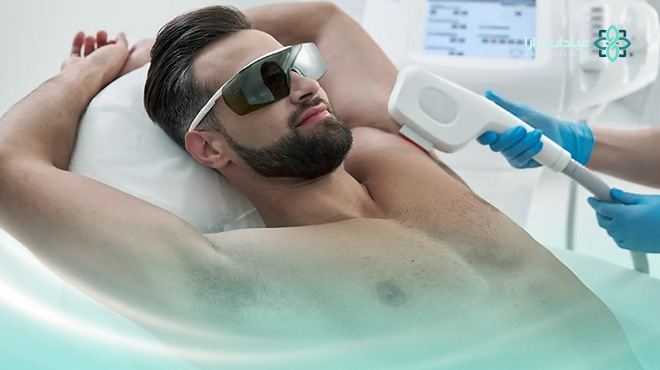 سعر-ازالة-الشعر-بالليزر-للرجال