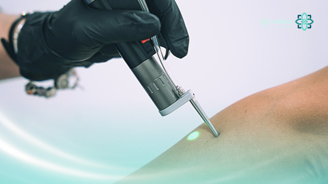 epicare-laser-جهاز