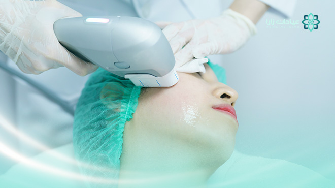 ما-هي-فوائد-جهاز-الهايفو-للوجه