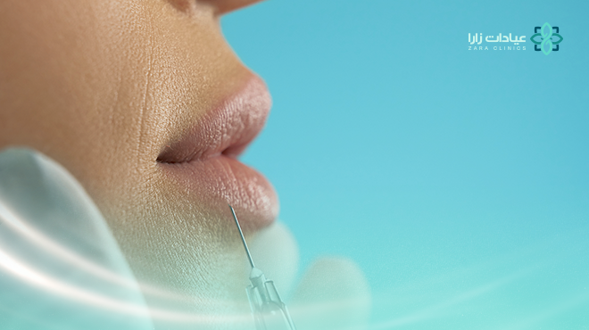 لقطة-قريبة-توضح-إجراء-حقن-تجميلي-بالإبرة-بالقرب-من-منطقة-الشفاه-والفم-لإبراز-الفرق-بين-البوتوكس-و-الفيلر-وتوضيح-نقاط-حقن-البوتوكس-في-الوجه لقطة-قريبة-توضح-إجراء-حقن-تجميلي-بالإبرة-بالقرب-من-منطقة-الشفاه-والفم-لإبراز-الفرق-بين-البوتوكس-و-الفيلر-وتوضيح-نقاط-حقن-البوتوكس-في-الوجه