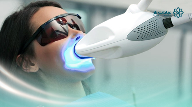 سعر-تبييض-الاسنان-بالليزر