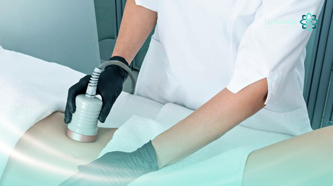 تجربتي-مع-نحت-الجسم-بالليزر